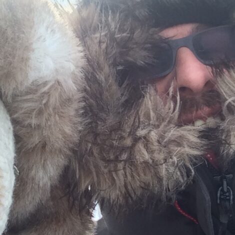 Gesicht im Winter besonders schützen